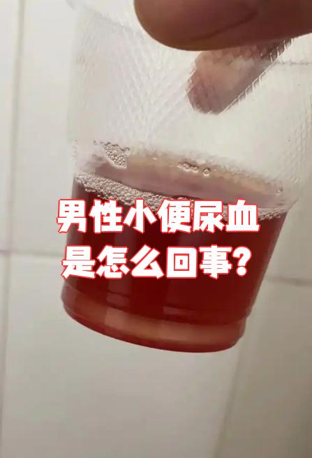 忻尔雅