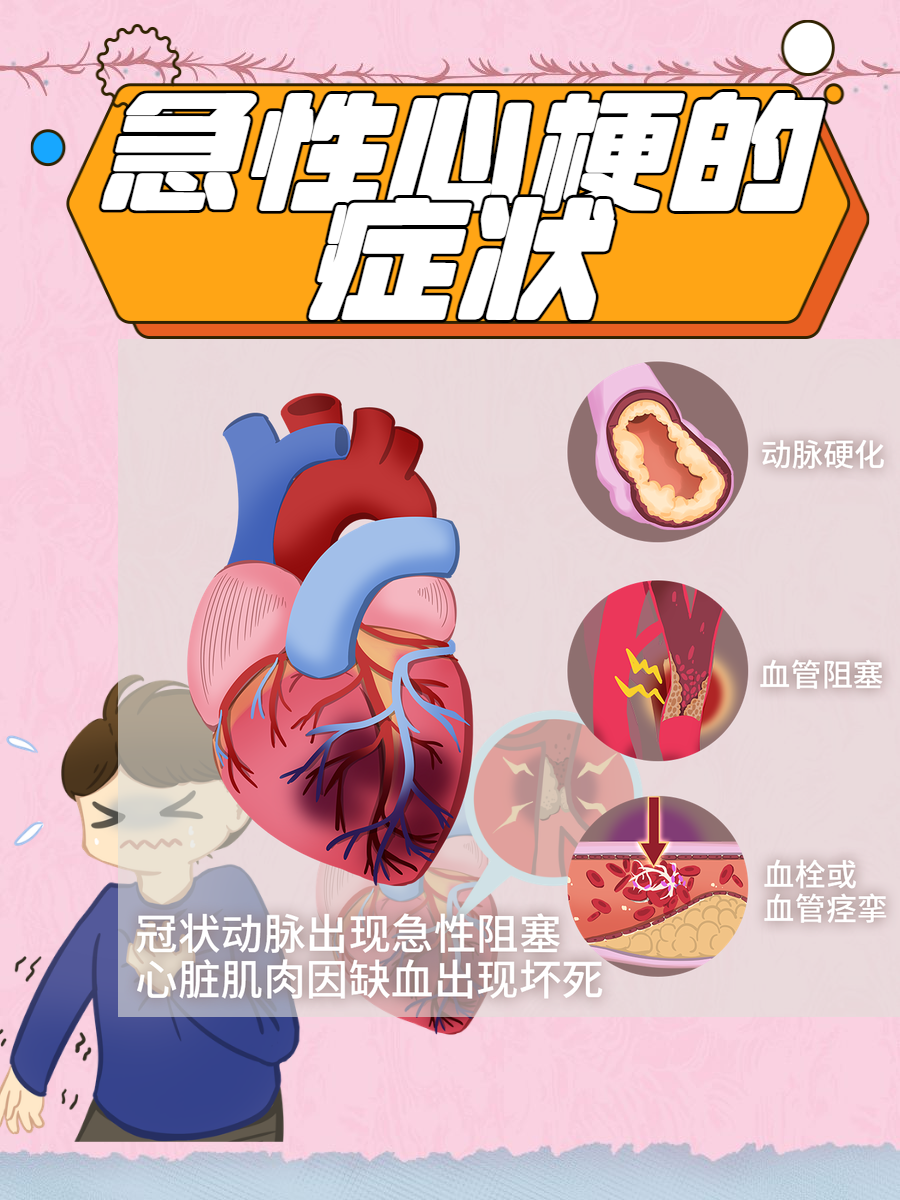心梗的前兆有哪些