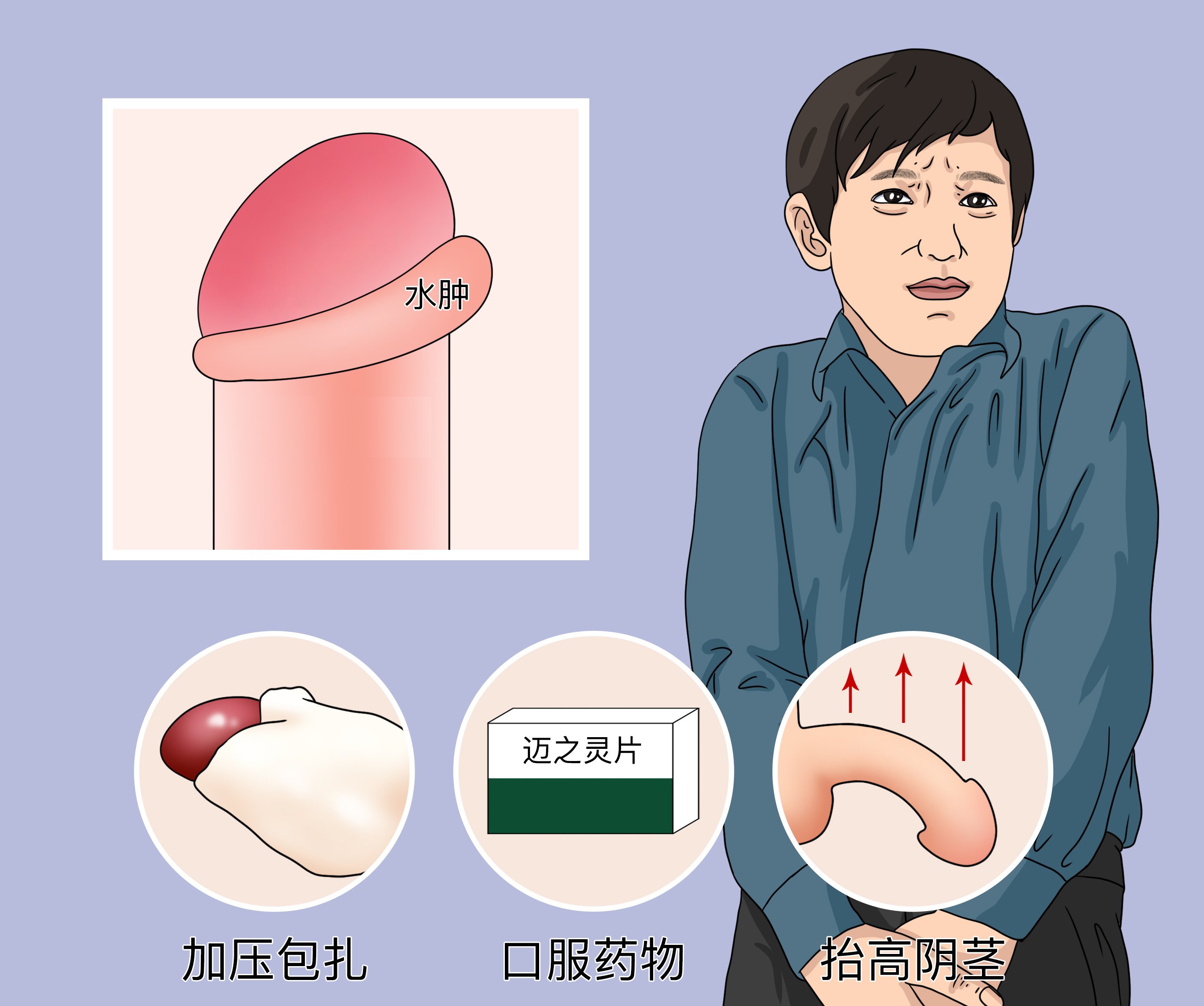 割了包皮后图片