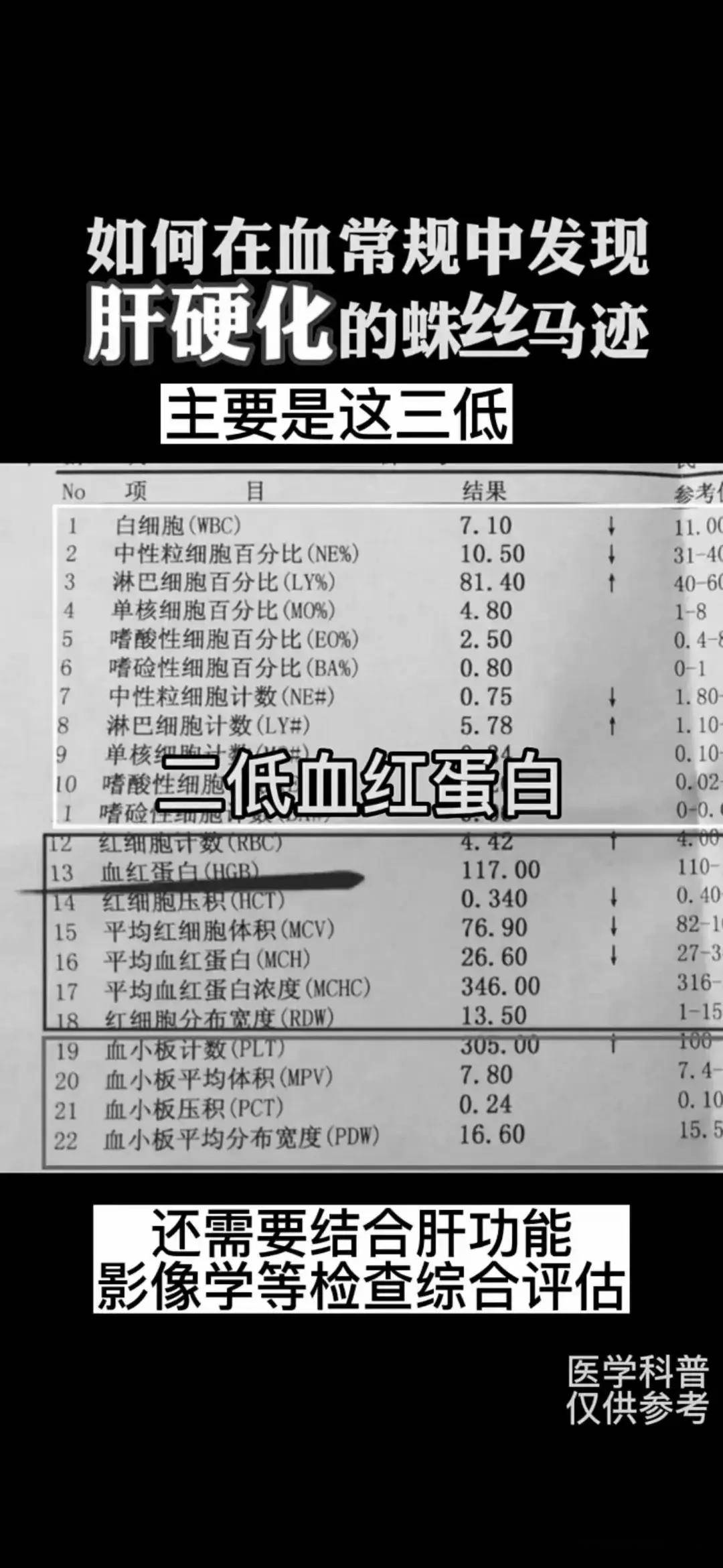 白血病血常规报告单
