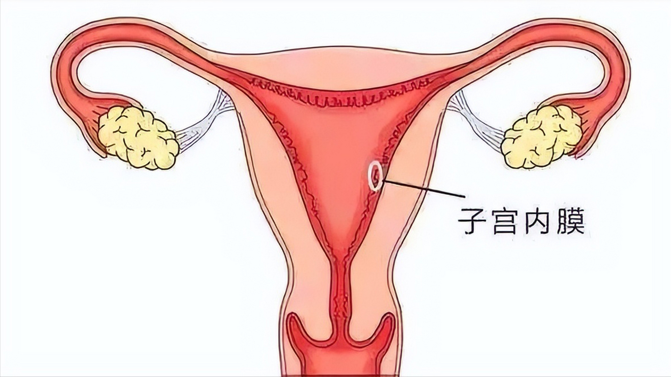 子宫内膜增厚能癌变吗