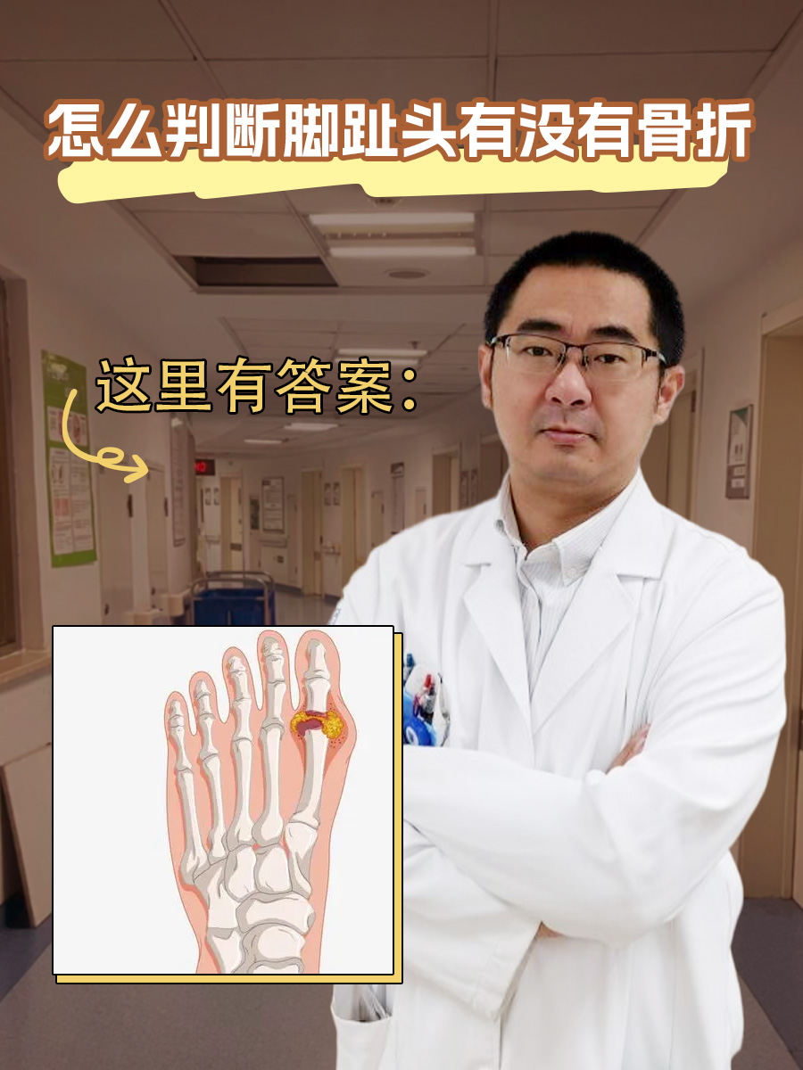 小脚趾骨折了20天可以下地走路吗