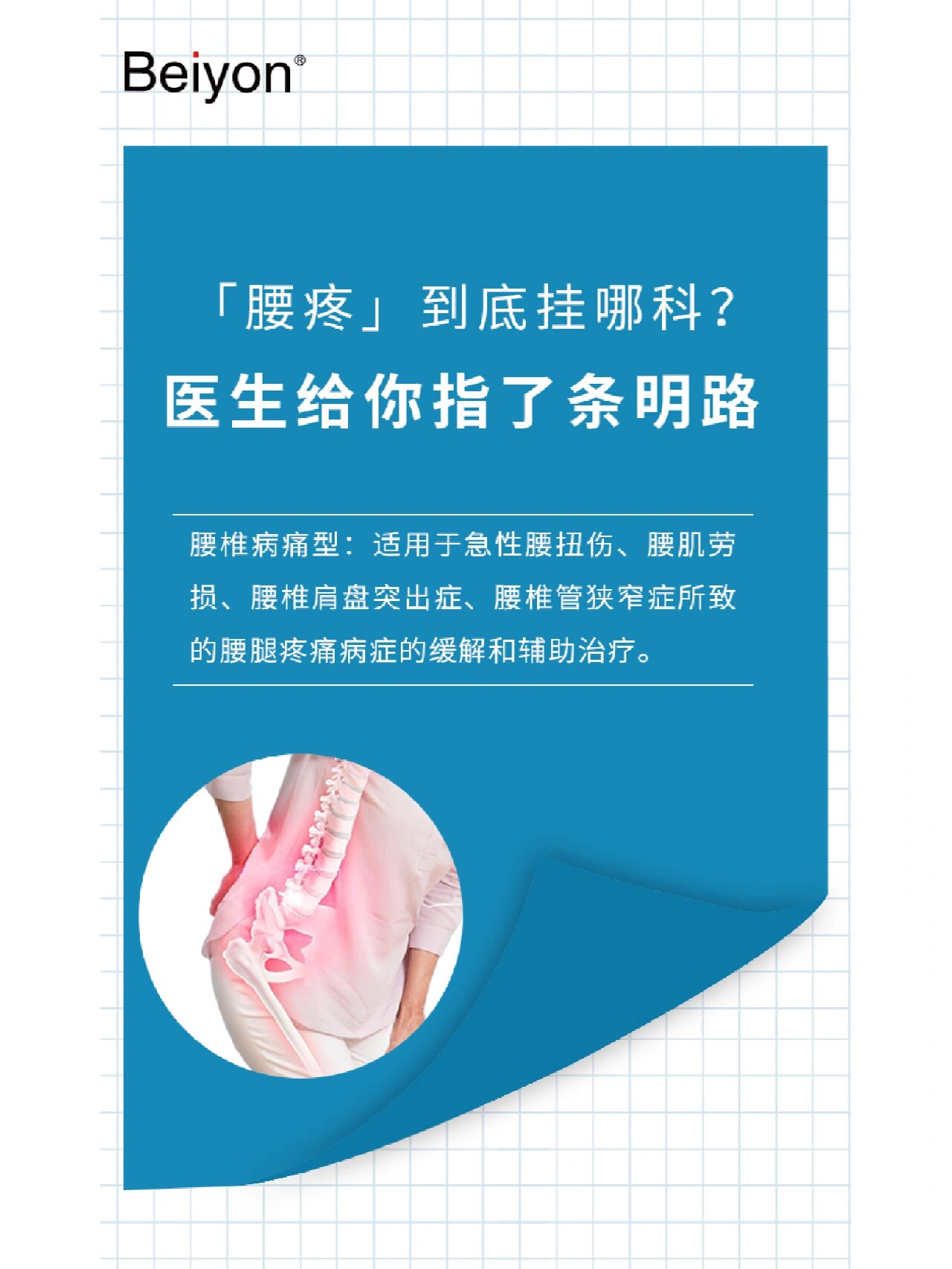 腰肌劳损挂什么科?