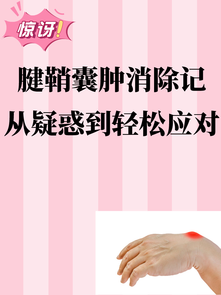 腱鞘囊肿怎么治最好