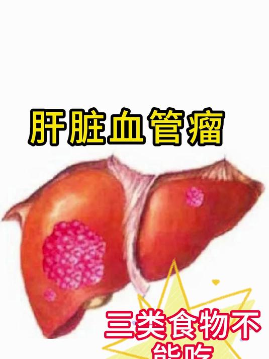 睦飇