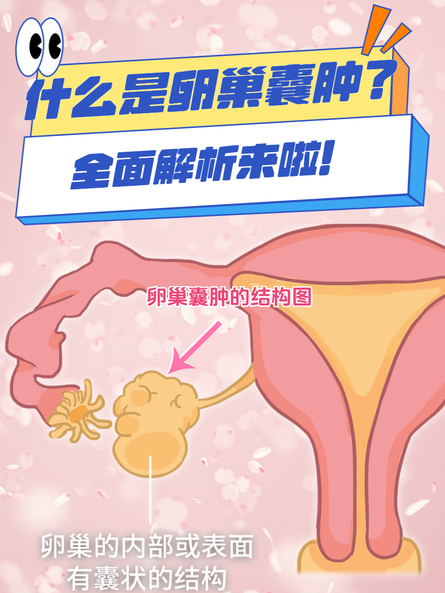 什么是卵巢囊肿?