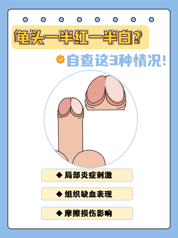 龟头发红咋回事