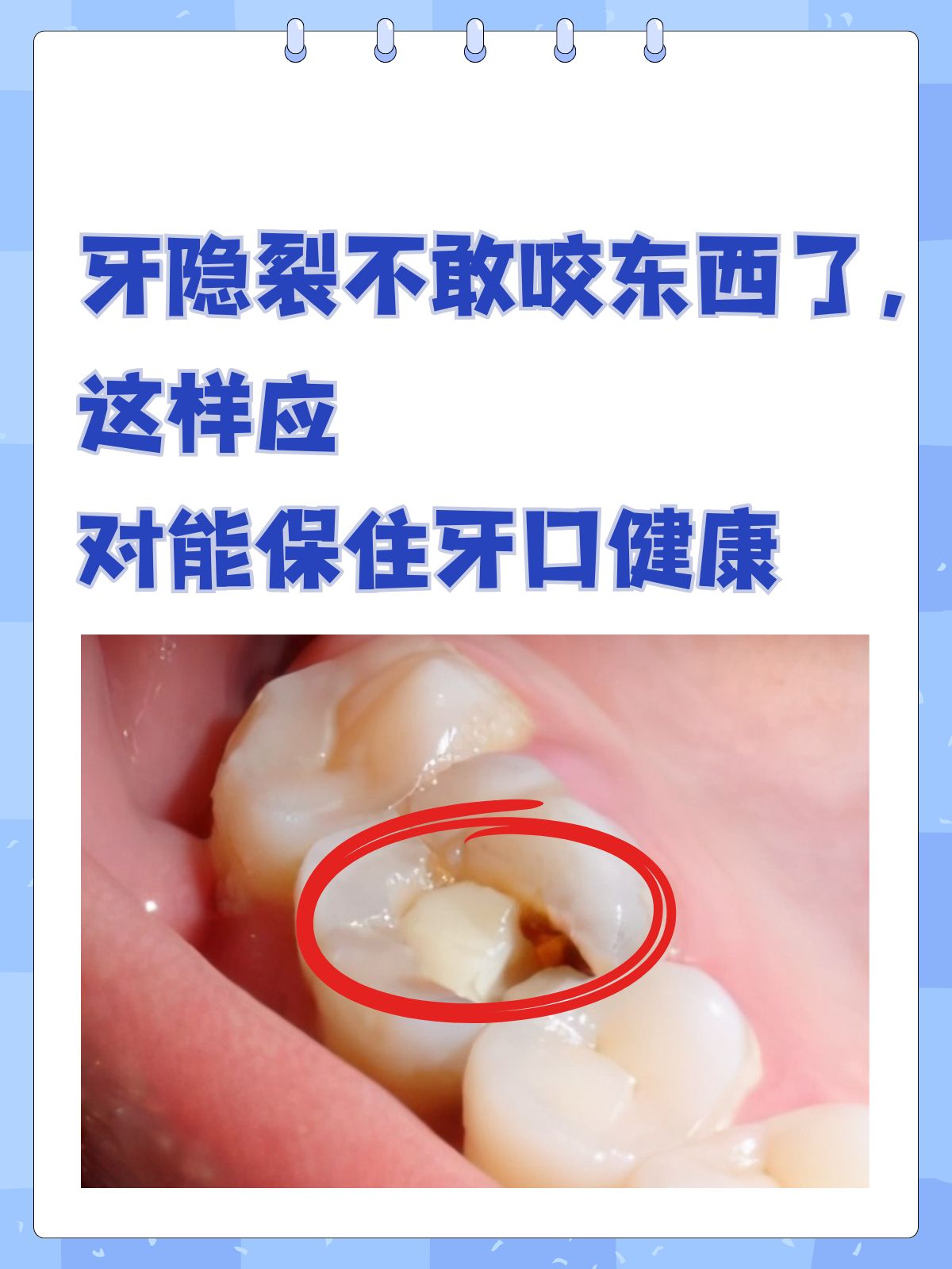 牙痒想咬东西是怎么回事