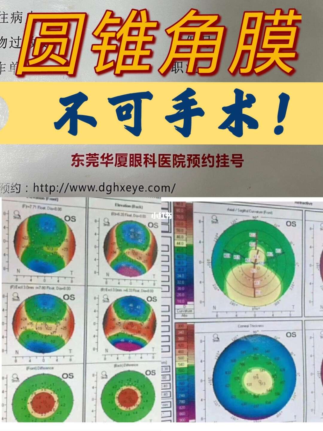 为什么perthes试验阳性者,不可手术