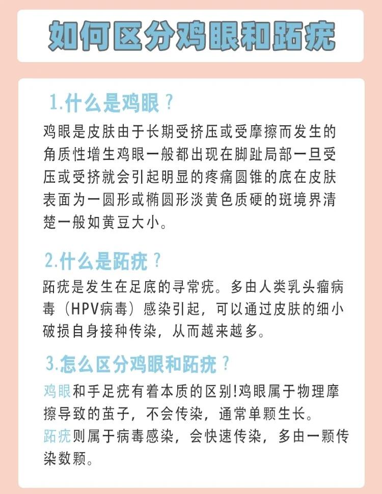 鸡眼和跖疣的区别