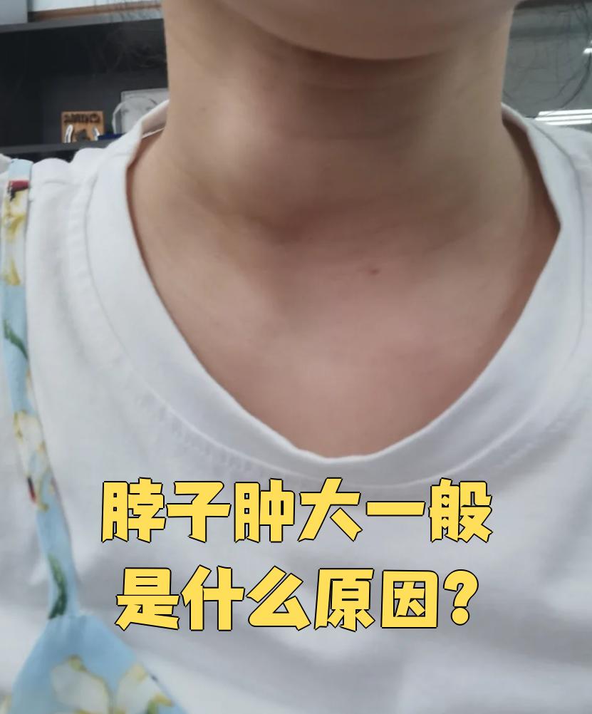 脖子粗怎么办?