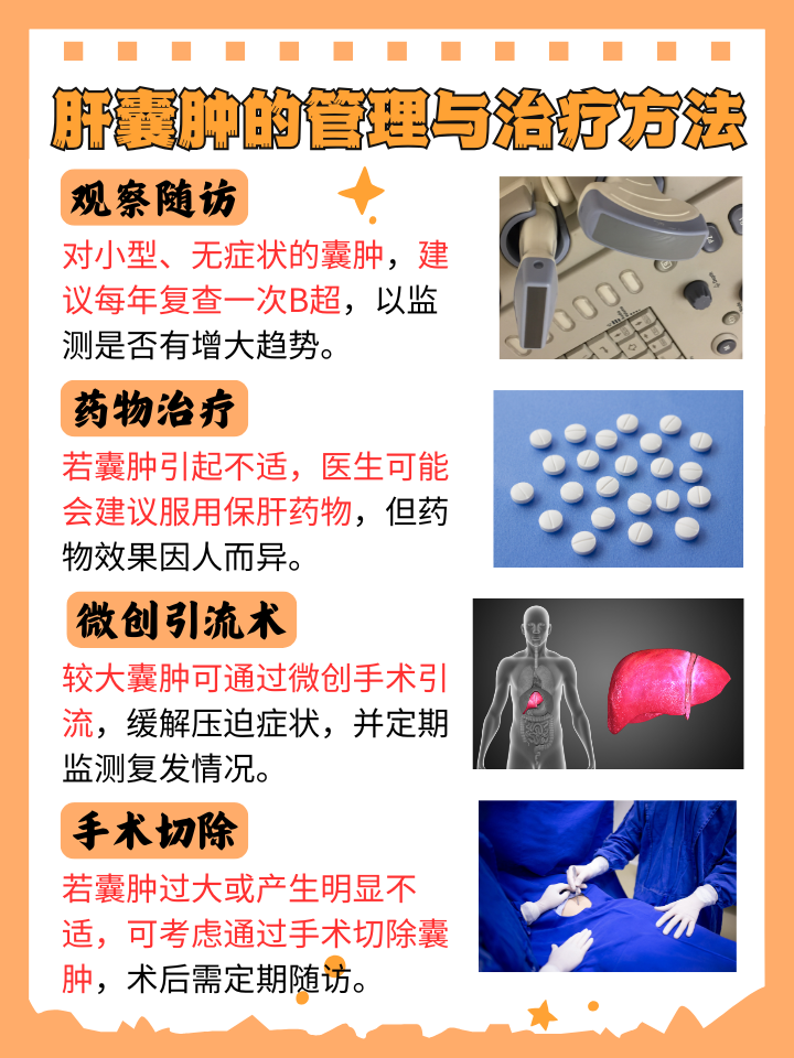 肝囊肿是什么?