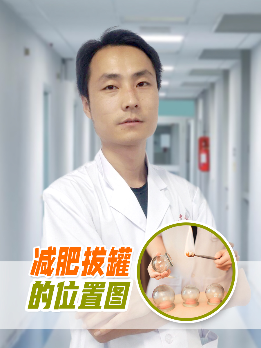 减肥拔罐穴位图分享拔罐减肥施罐法操作