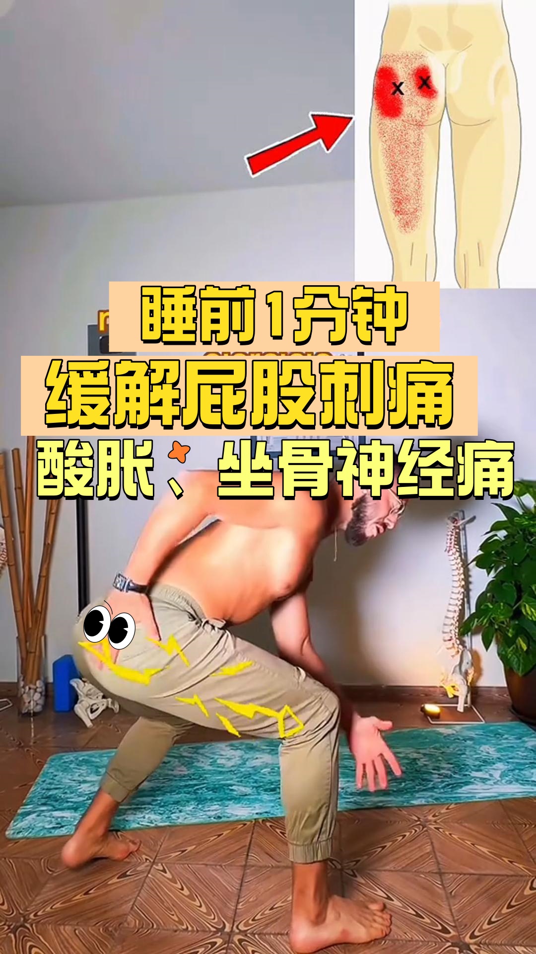 坐骨神经痛怎么治疗比较好