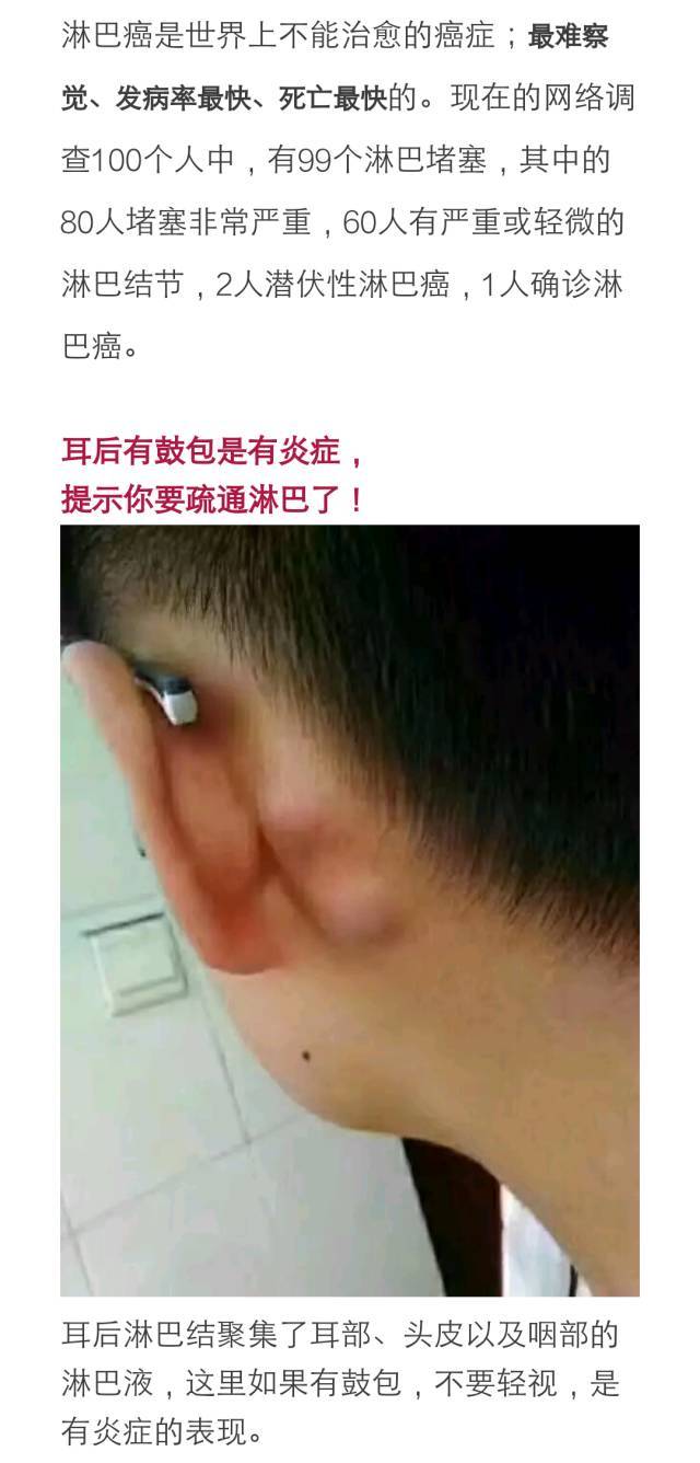 耳后淋巴结肿大