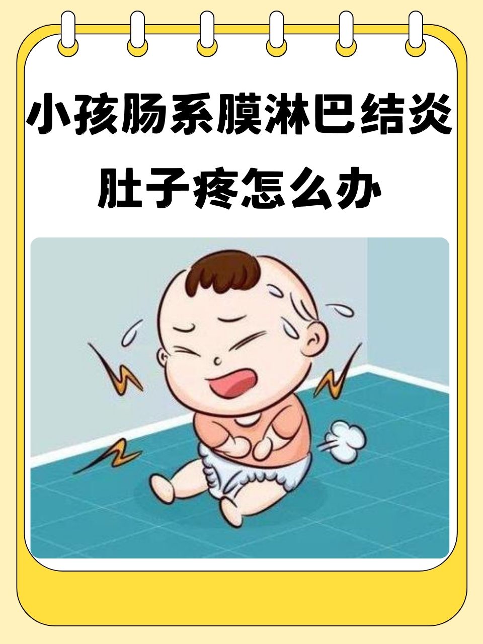 自发性腹膜炎是什么