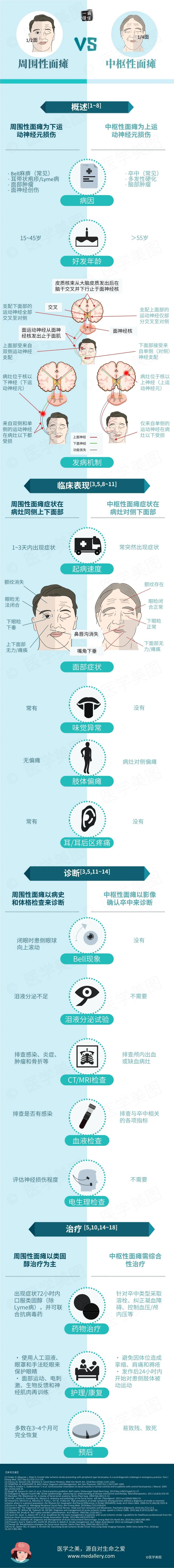 面神经瘫痪是怎么回事