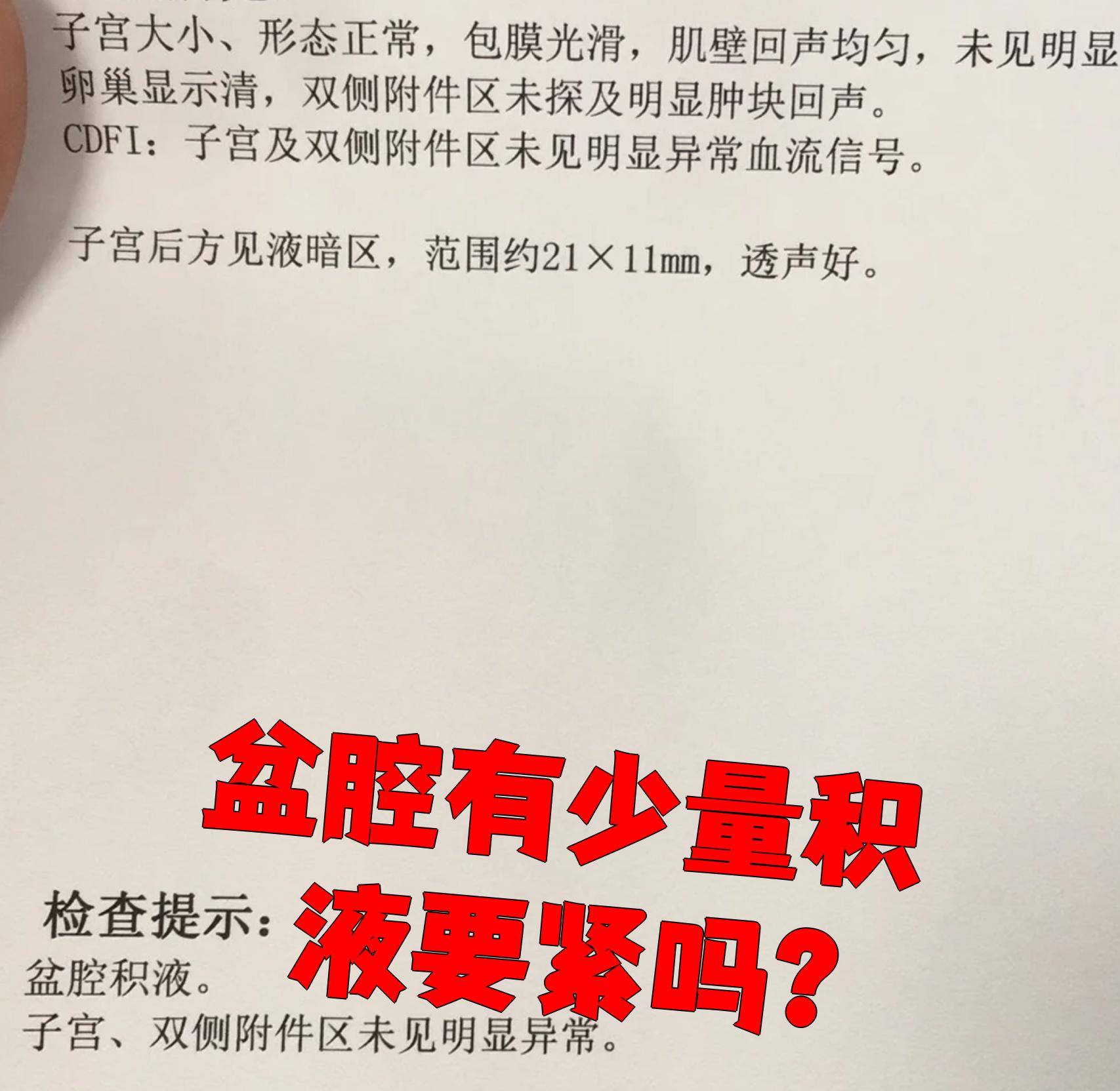 陶氏腔积液是什么意思