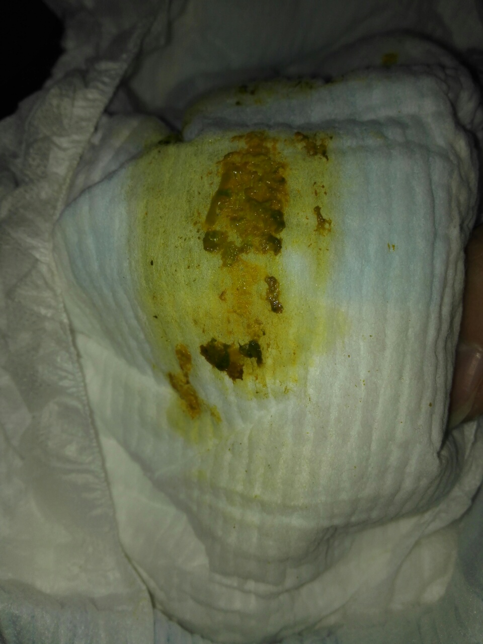 大便黑绿色是在排毒吗