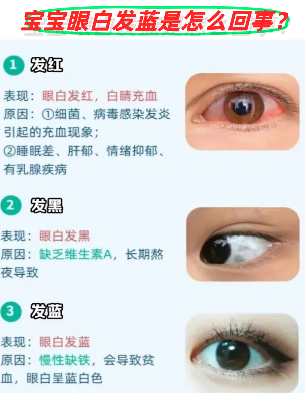 宝宝眼里有红血丝怎么回事