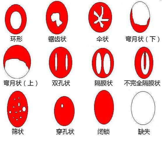 第一次进不去怎么办?