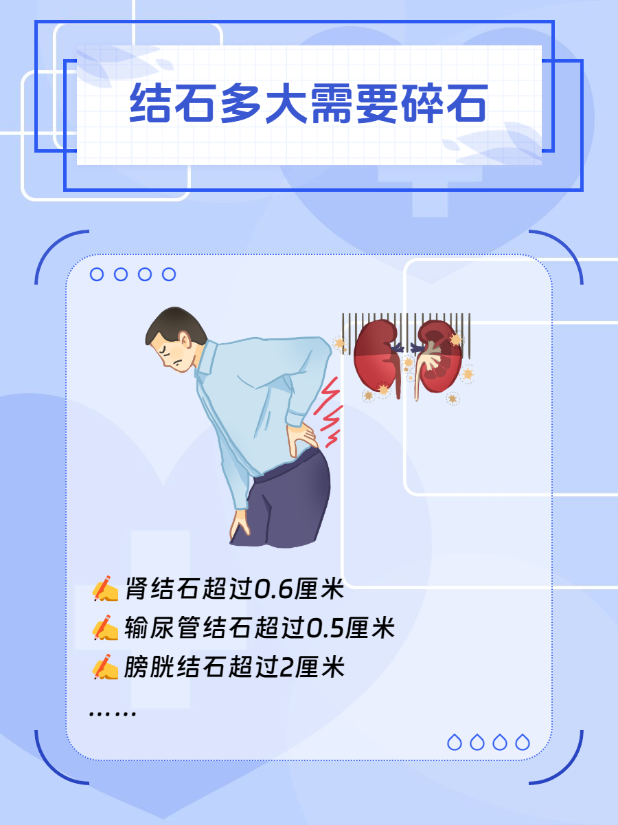 人为什么会得肾结石