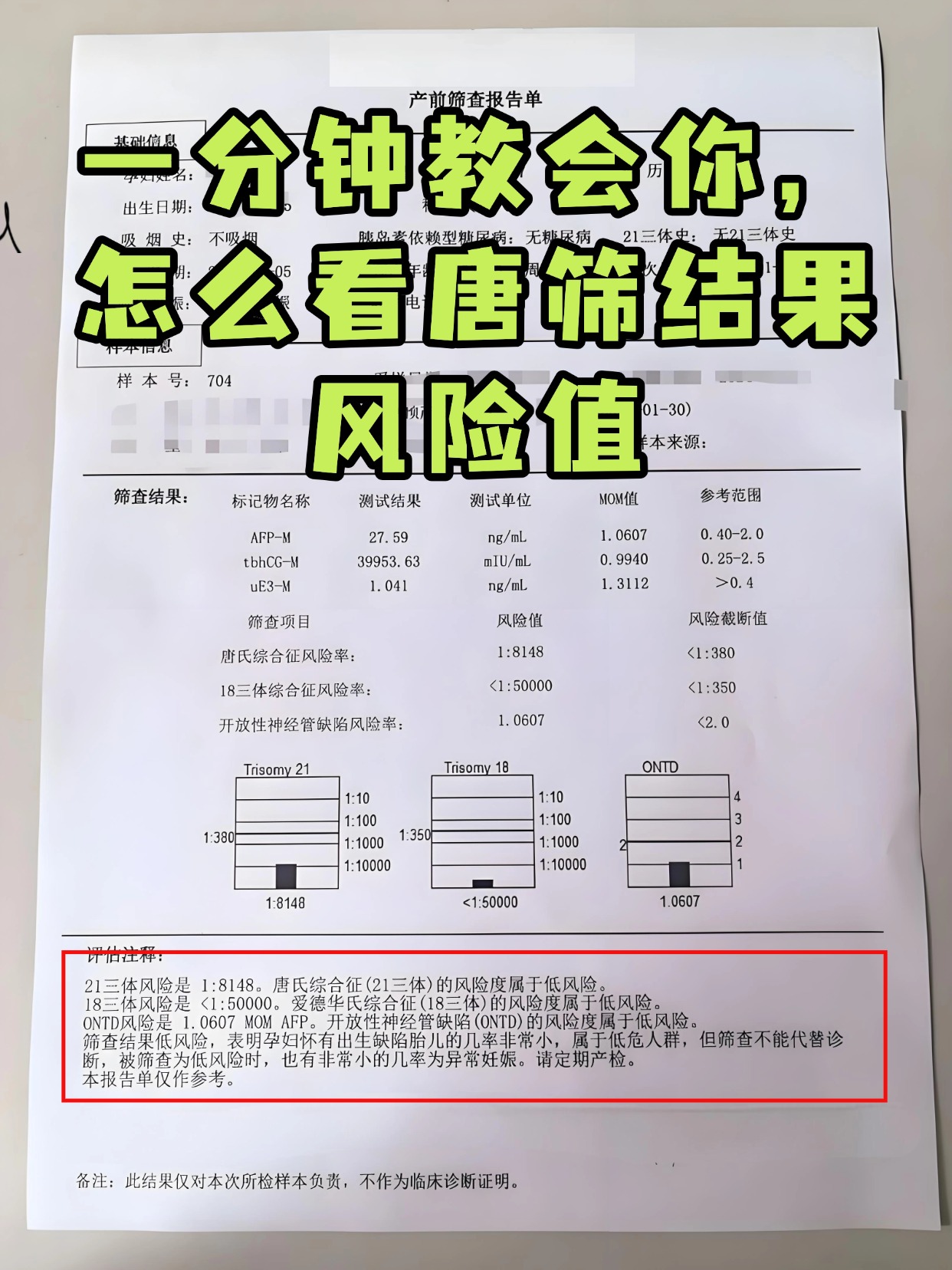 唐筛21三体正常范围值是多少