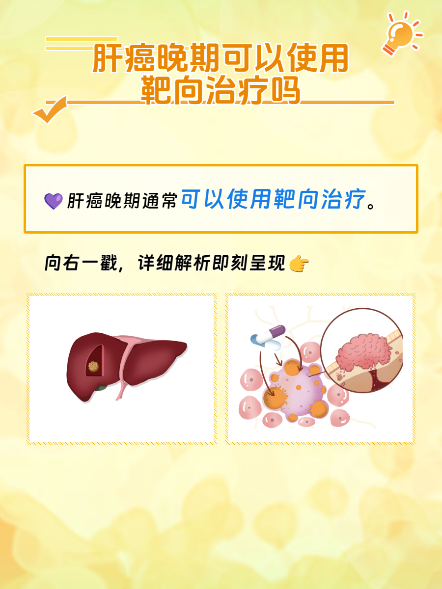 肝癌晚期做了12次介入