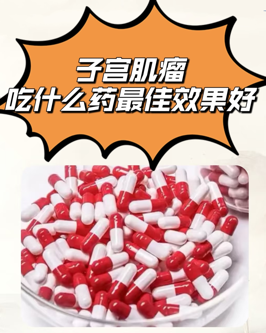 吃什么药能治子宫肌瘤