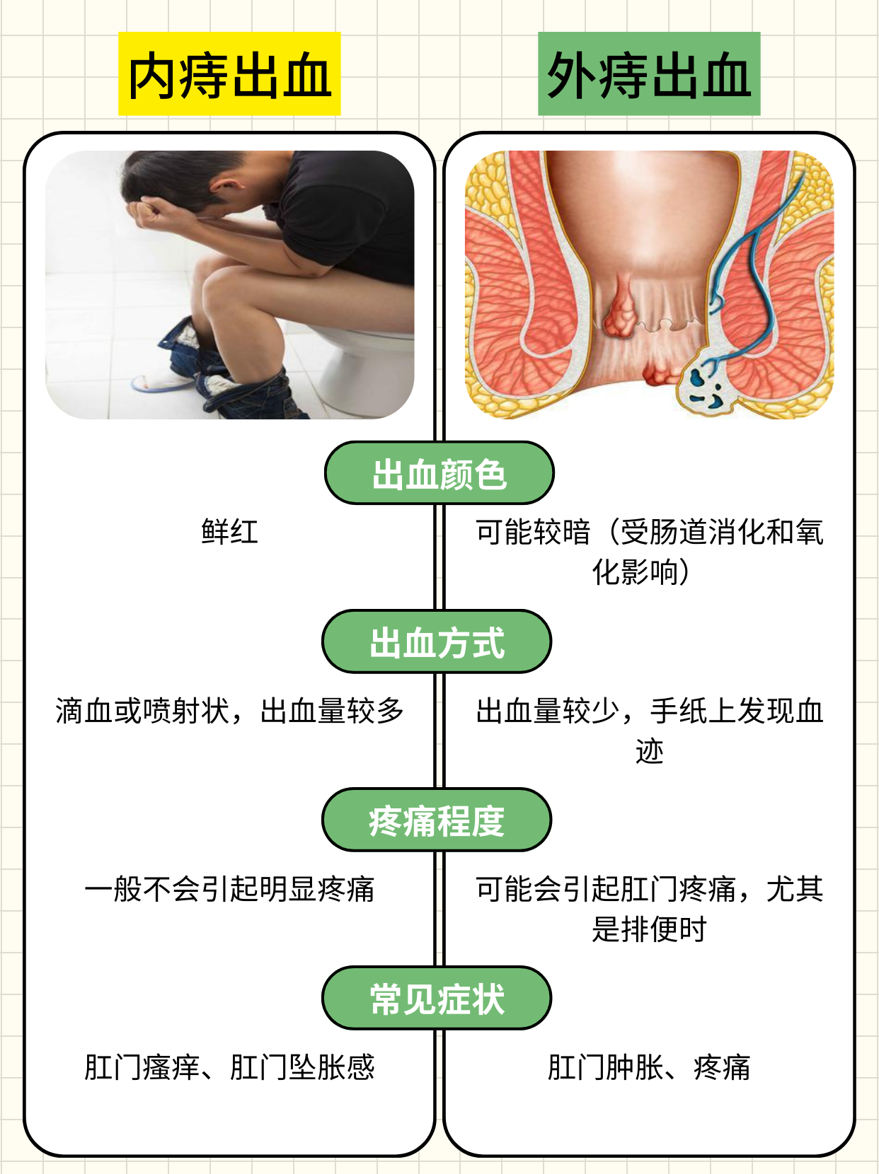 痔疮出血一般几天能好