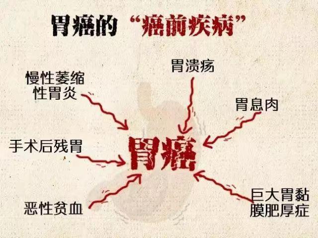 胃溃疡和胃癌区别
