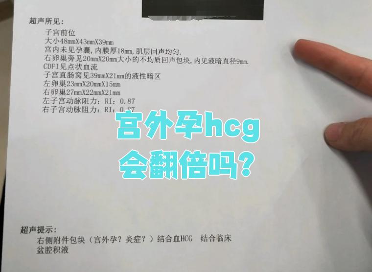 hcg值多少是宫外孕
