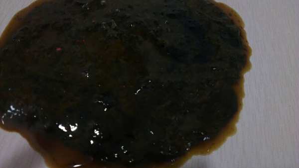 一岁拉黑色大便因为什么