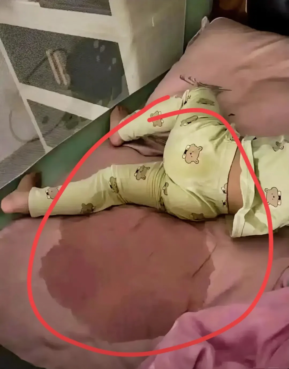 小儿遗尿症是什么