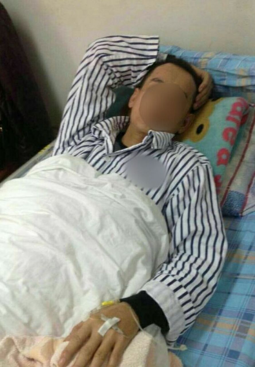 肝癌晚期临死前症状