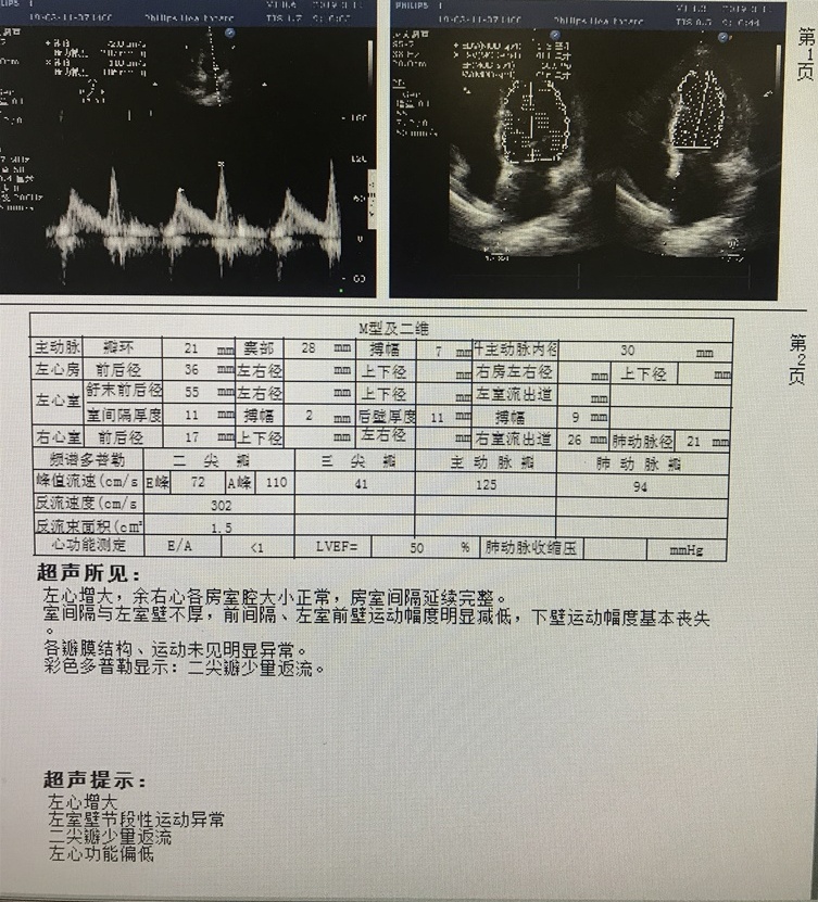 心衰做什么检查来确诊