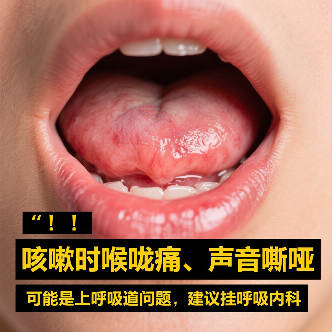 嗓子疼挂什么科