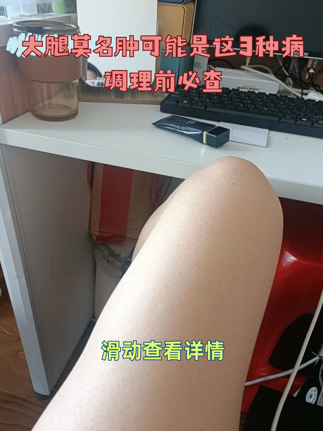 腿肿是什么病的前兆