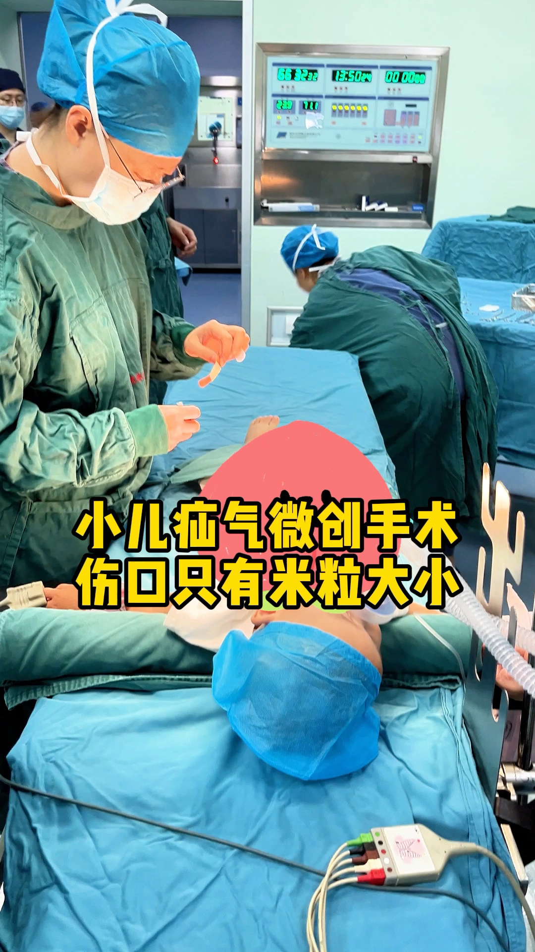 小孩疝气治疗