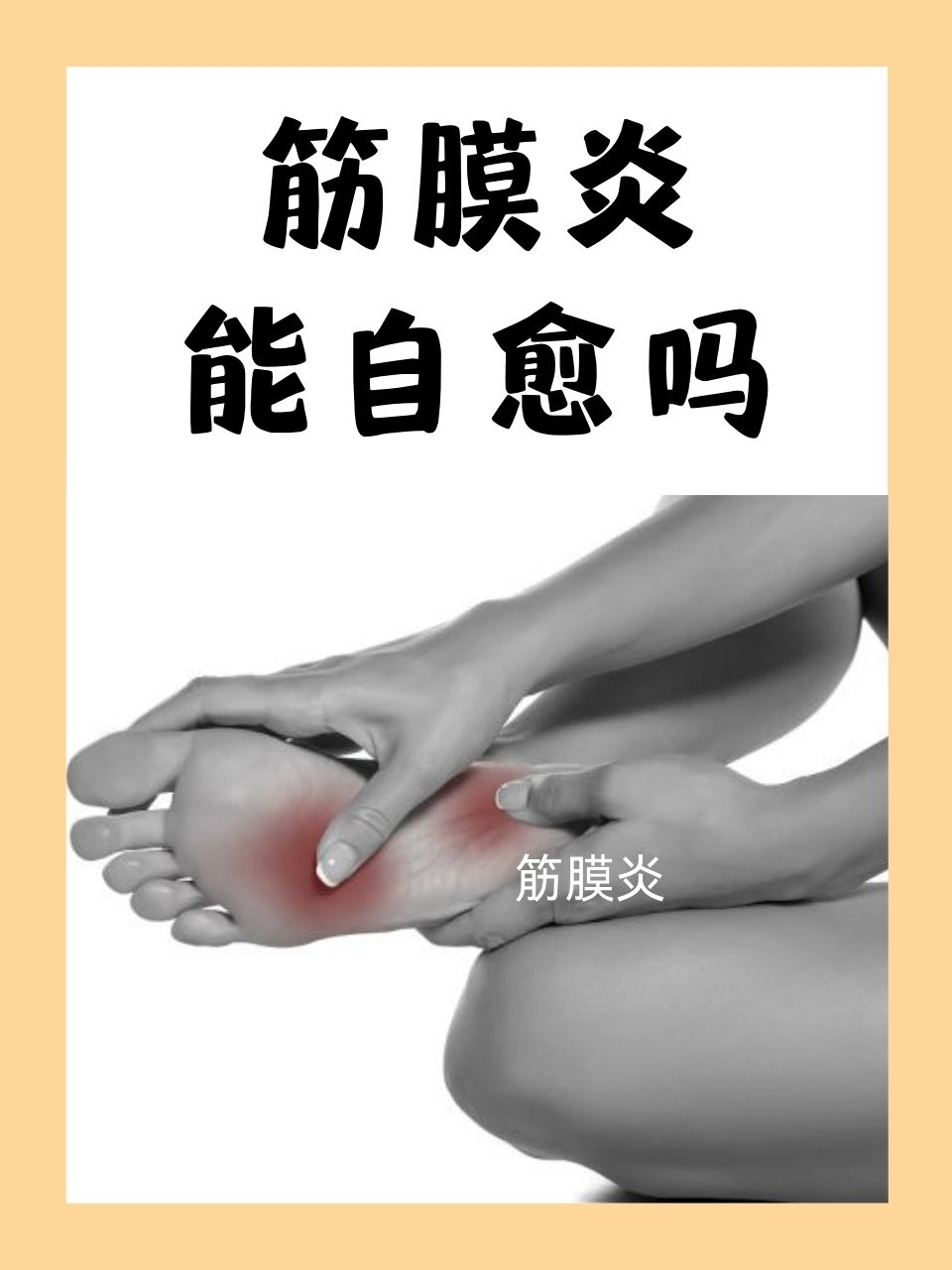 筋膜炎如何彻底治愈