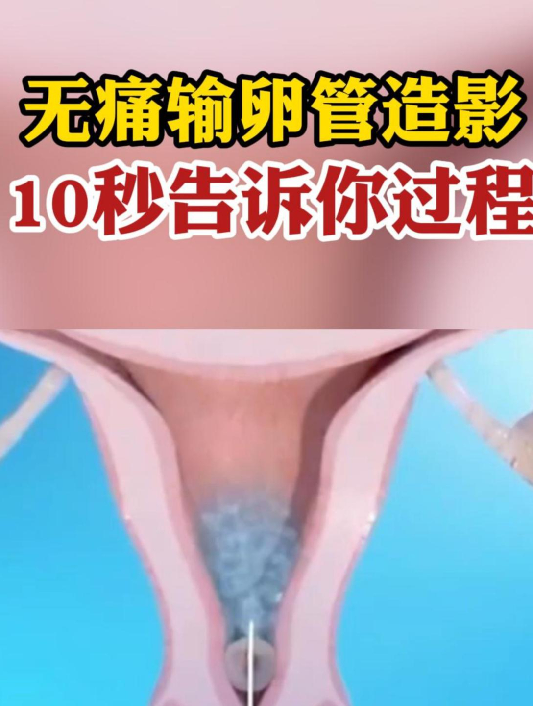 造影手术疼吗?