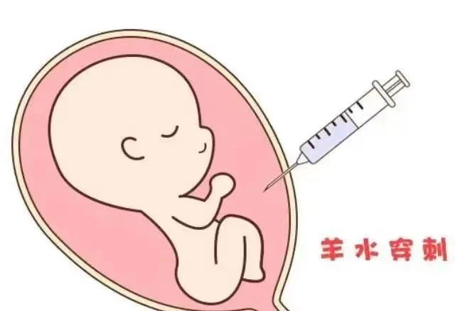 羊水穿刺一般多少钱