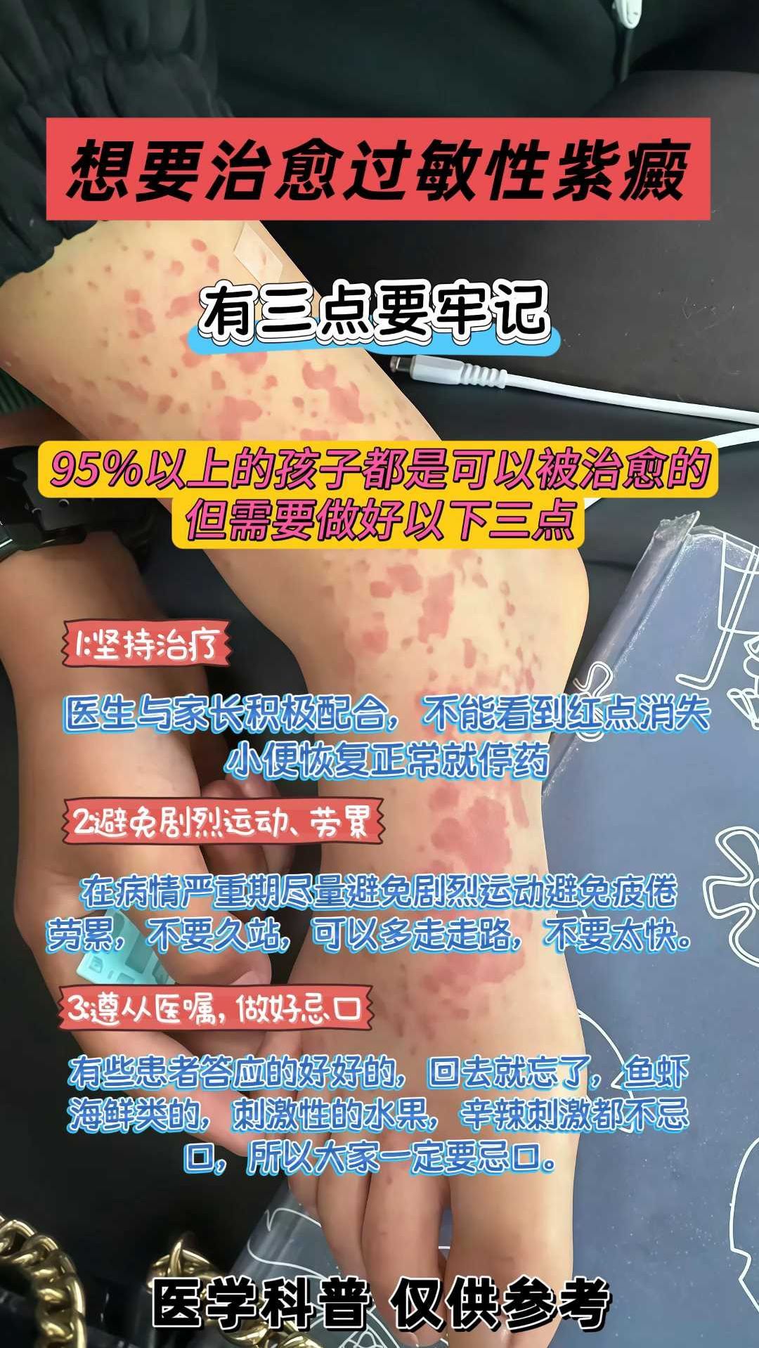 紫癜可以治愈吗?