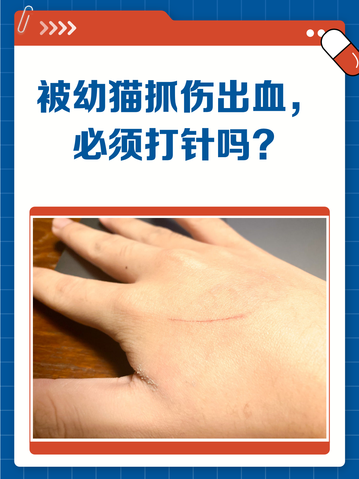猫爪里有狂犬病吗?????谢谢谢谢