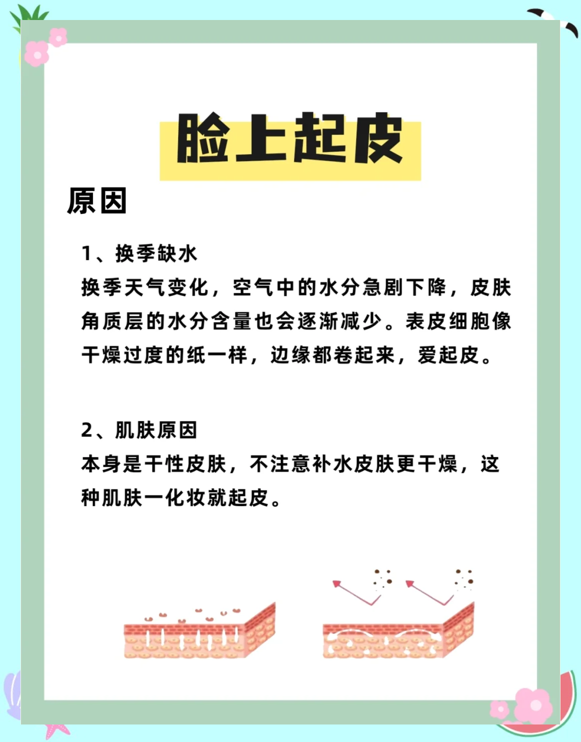 身上皮肤干燥起皮怎么办