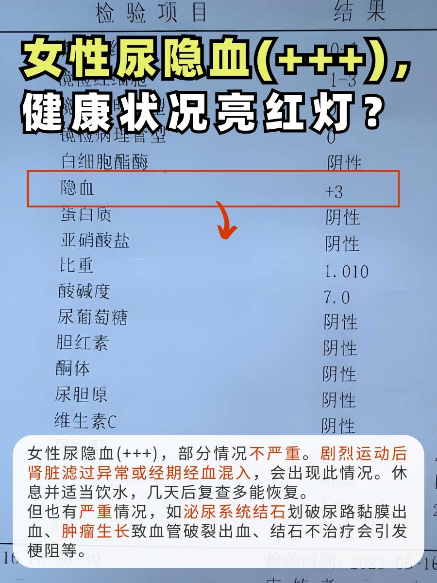 尿检时胆红素1十是什么意