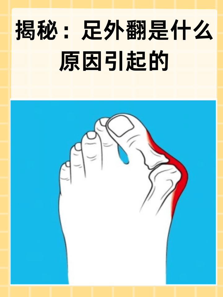 脚骨头突出来了,为什么