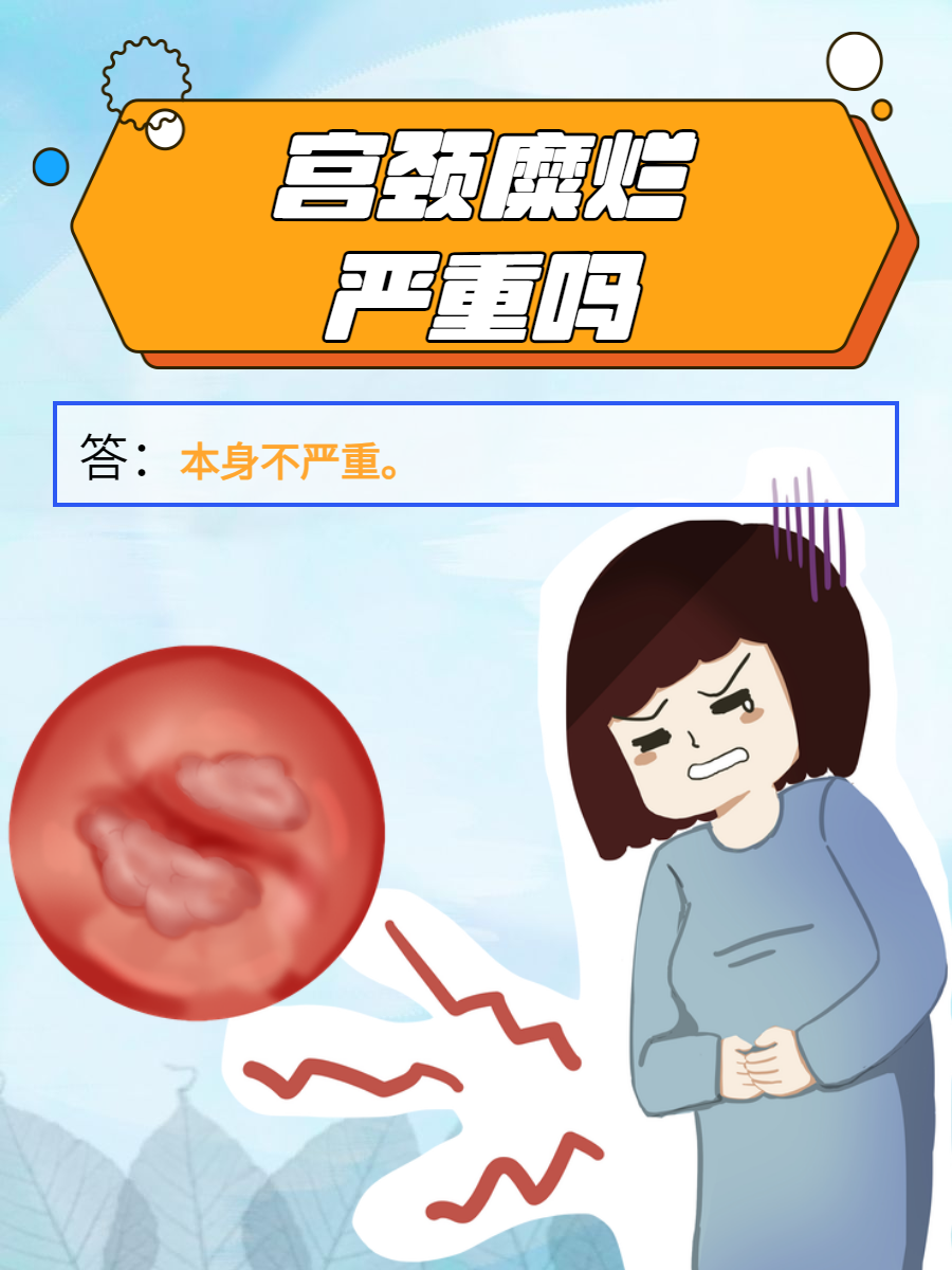 中度宫颈糜烂严重吗?
