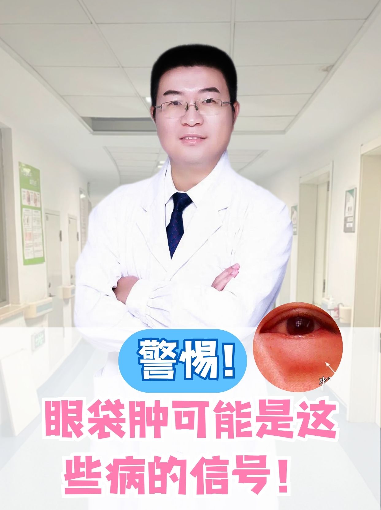 眼袋水肿怎么办?