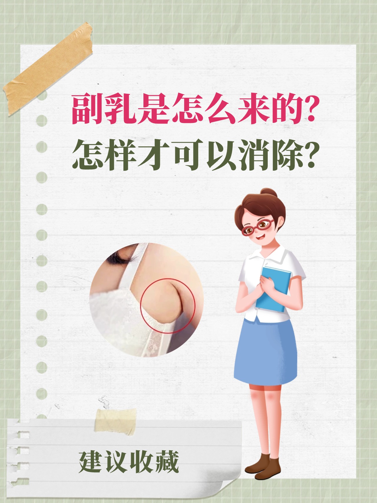 副乳是如何形成的
